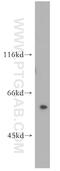 Peter Pan Homolog antibody, 11006-1-AP, Proteintech Group, Western Blot image 
