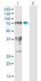 Splicing Factor 1 antibody, H00007536-M01, Novus Biologicals, Western Blot image 