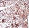 Phosphoenolpyruvate Carboxykinase 1 antibody, LS-C101193, Lifespan Biosciences, Immunohistochemistry paraffin image 