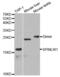 Epididymal Peptidase Inhibitor antibody, abx001761, Abbexa, Western Blot image 