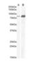 Cholecystokinin B Receptor antibody, orb19186, Biorbyt, Western Blot image 