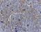 CD72 Molecule antibody, A09292-2, Boster Biological Technology, Immunohistochemistry paraffin image 