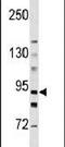 Hexokinase 3 antibody, PA5-15441, Invitrogen Antibodies, Western Blot image 