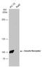 Insulin Receptor antibody, GTX101136, GeneTex, Western Blot image 