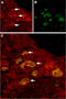 Transient Receptor Potential Cation Channel Subfamily V Member 6 antibody, GTX54869, GeneTex, Immunohistochemistry frozen image 