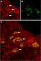 Transient receptor potential cation channel subfamily V member 6 antibody, GTX54869, GeneTex, Immunohistochemistry frozen image 