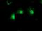 Mannose Phosphate Isomerase antibody, NBP2-02043, Novus Biologicals, Immunocytochemistry image 
