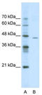 Amiloride-sensitive cation channel 4 antibody, TA338786, Origene, Western Blot image 