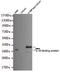 Interleukin 18 Binding Protein antibody, TA346979, Origene, Western Blot image 