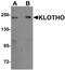 Klotho antibody, orb95570, Biorbyt, Western Blot image 