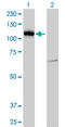 LLGL Scribble Cell Polarity Complex Component 2 antibody, LS-C104985, Lifespan Biosciences, Western Blot image 