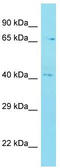 Chromosome 12 Open Reading Frame 56 antibody, TA332161, Origene, Western Blot image 