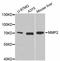 Matrix Metallopeptidase 2 antibody, A6247, ABclonal Technology, Western Blot image 