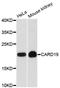 Caspase Recruitment Domain Family Member 19 antibody, A13064-1, Boster Biological Technology, Western Blot image 