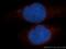 Transcription Factor EB antibody, 13372-1-AP, Proteintech Group, Immunofluorescence image 