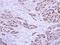 RPA34 antibody, LS-C186287, Lifespan Biosciences, Immunohistochemistry paraffin image 