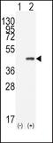 Caudal Type Homeobox 2 antibody, PA5-13122, Invitrogen Antibodies, Western Blot image 