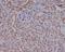 RAD51 Recombinase antibody, M00088-1, Boster Biological Technology, Immunohistochemistry paraffin image 