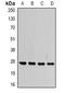 VAMP Associated Protein B And C antibody, orb340902, Biorbyt, Western Blot image 