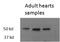 Thyroid Hormone Receptor Beta antibody, NB100-93535, Novus Biologicals, Western Blot image 