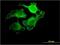 Unc-5 Family C-Terminal Like antibody, MA5-23197, Invitrogen Antibodies, Immunofluorescence image 