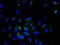 SRP Receptor Subunit Beta antibody, A51421-100, Epigentek, Immunofluorescence image 