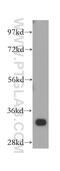 Actin Related Protein 2/3 Complex Subunit 2 antibody, 15058-1-AP, Proteintech Group, Western Blot image 