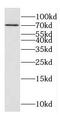 DnaJ Heat Shock Protein Family (Hsp40) Member C21 antibody, FNab02464, FineTest, Western Blot image 