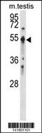 PTPN1 antibody, 60-913, ProSci, Western Blot image 