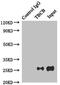 Tubulin Folding Cofactor B antibody, A61254-100, Epigentek, Western Blot image 