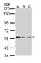 CLN2 antibody, NBP1-31758, Novus Biologicals, Western Blot image 