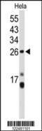 Centromere Protein H antibody, 63-840, ProSci, Western Blot image 