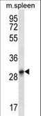 Keratin 222 antibody, LS-C165619, Lifespan Biosciences, Western Blot image 