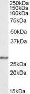 NADH:Ubiquinone Oxidoreductase Core Subunit S3 antibody, TA305654, Origene, Western Blot image 