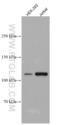 Unp antibody, 66822-1-Ig, Proteintech Group, Western Blot image 