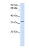 Docking Protein 5 antibody, NBP1-56411, Novus Biologicals, Western Blot image 