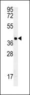 Glycerophosphodiester Phosphodiesterase Domain Containing 3 antibody, 57-383, ProSci, Western Blot image 