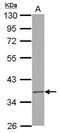 RNA Pseudouridine Synthase D3 antibody, GTX122992, GeneTex, Western Blot image 