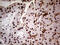 Histone-lysine N-methyltransferase NSD3 antibody, M32443, Boster Biological Technology, Immunohistochemistry paraffin image 