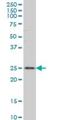 Ras-related protein Rab-7L1 antibody, H00008934-M03, Novus Biologicals, Western Blot image 