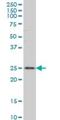 RAB29, Member RAS Oncogene Family antibody, H00008934-M03, Novus Biologicals, Western Blot image 