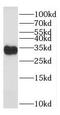 Translational Activator Of Cytochrome C Oxidase I antibody, FNab08470, FineTest, Western Blot image 