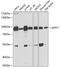 Glutamine--Fructose-6-Phosphate Transaminase 1 antibody, GTX64638, GeneTex, Western Blot image 