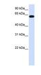 Heparan Sulfate 6-O-Sulfotransferase 3 antibody, NBP1-91328, Novus Biologicals, Western Blot image 