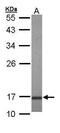 Ubiquitin-conjugating enzyme E2 A antibody, PA5-27186, Invitrogen Antibodies, Western Blot image 