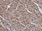 Rab Geranylgeranyltransferase Subunit Beta antibody, NBP2-20048, Novus Biologicals, Immunohistochemistry paraffin image 