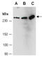 Mediator Complex Subunit 13 antibody, R1721-1, Abiocode, Western Blot image 