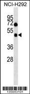 Hypocretin Receptor 1 antibody, 58-271, ProSci, Western Blot image 