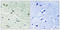 MER Proto-Oncogene, Tyrosine Kinase antibody, LS-C199253, Lifespan Biosciences, Immunohistochemistry frozen image 
