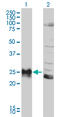 Major Histocompatibility Complex, Class II, DP Beta 1 antibody, LS-B12862, Lifespan Biosciences, Western Blot image 